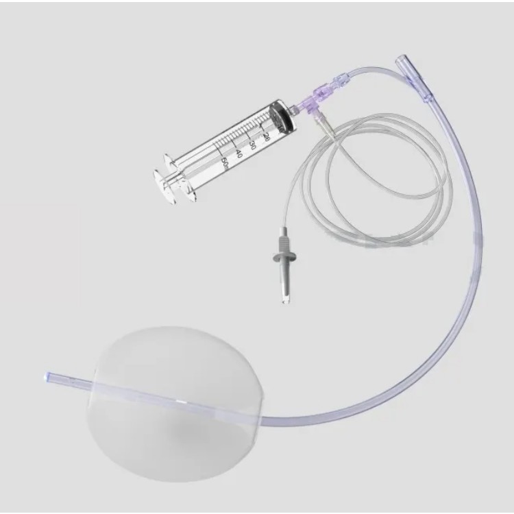 POSTPARTUM HEMOSTASIS BALLOON